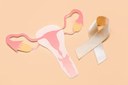 Câmara de Cachoeiro aprova criação da Semana de Conscientização sobre Endometriose Câmara de Cachoeiro aprova criação da Semana de Conscientização sobre Endometriose